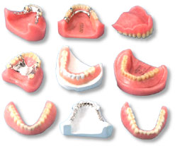 denture-types